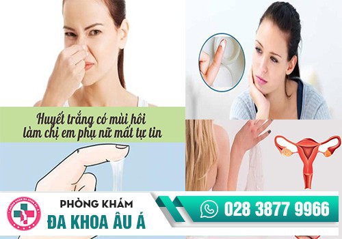 NGUYÊN NHÂN KHIẾN HUYẾT TRẮNG CÓ MÙI LẠ